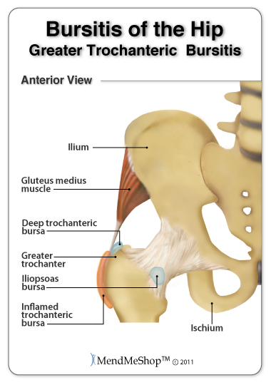 anatomy hip bursitis
